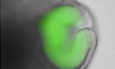 The man who grew eyes