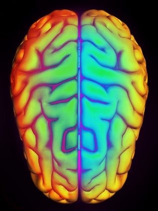Brain hemispheres