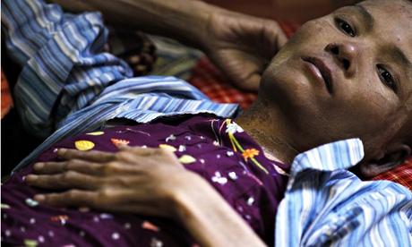 A patient at an HIV/Aids hospice in the suburbs of Rangoon