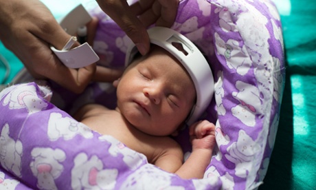 The Sohum device is tested on a baby at Vaani Vilas Hospital, Bangalore.