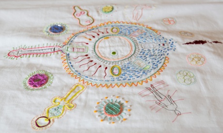 The embroidery on the front of the hospital gown by Tabitha Moses, showing symbols of her IVF experience.