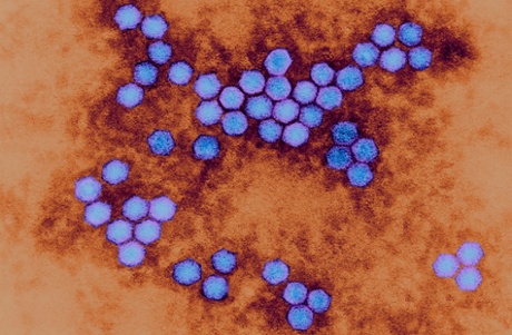 polio virus