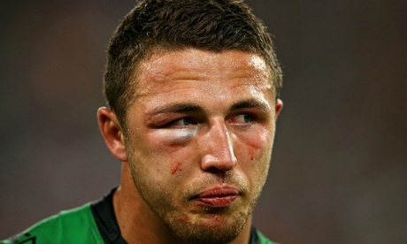 Sam Burgess played almost the entire NRL Grand Final with a fractured cheek-bone and eye socket.