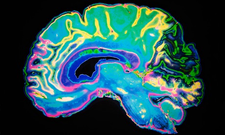 Artificially Coloured MRI Scan Of Human Brain