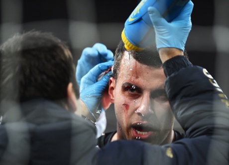 Steven Taylor, 'just a scratch'