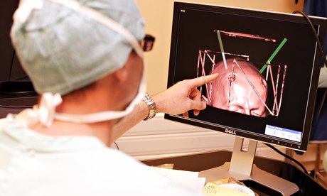 A neurosurgeon treats a patient with Parkinson's disease with thalamic stimulation, where electrodes