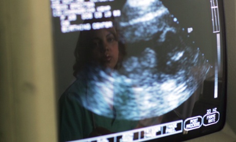 The law contained a “real-time view requirement,” which compels doctors or ultrasound technicians to perform an ultrasound on any woman seeking an abortion, display the sonogram to her, and describe the foetus in detail.