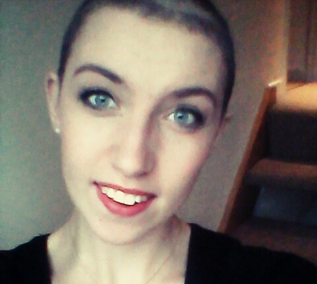 18 year old Roseanna Bentley has a condition called trichotillomania, which causes her to pull out her hair.