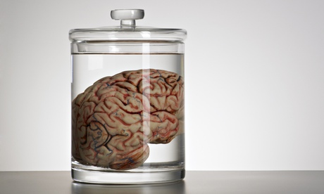A brain in a speciman jar.