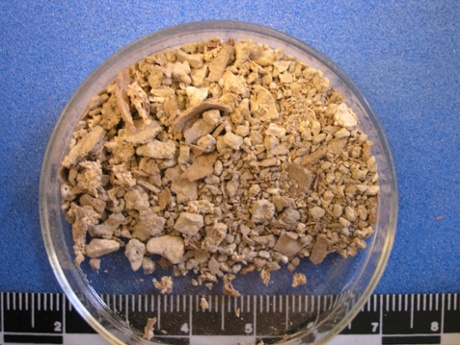 Debris from the base of Alington Avenue child's lead-liner