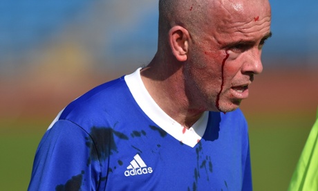 Rob Merrick of the Lobby Journalists leaves the pitch after being injured by Ed Balls.