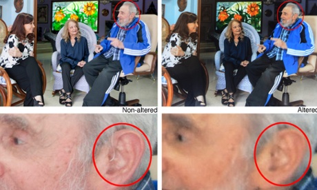 An Associated Press composite showing the two versions of Fidel Castro's ear.