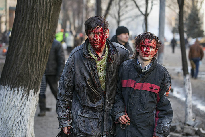 20 Photos: Wounded people walk after clashes with riot police in central Kiev