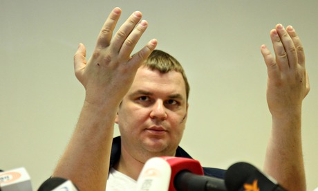 Dmytro Bulatov holds up his hands to show marks where he says nails were driven through his hands