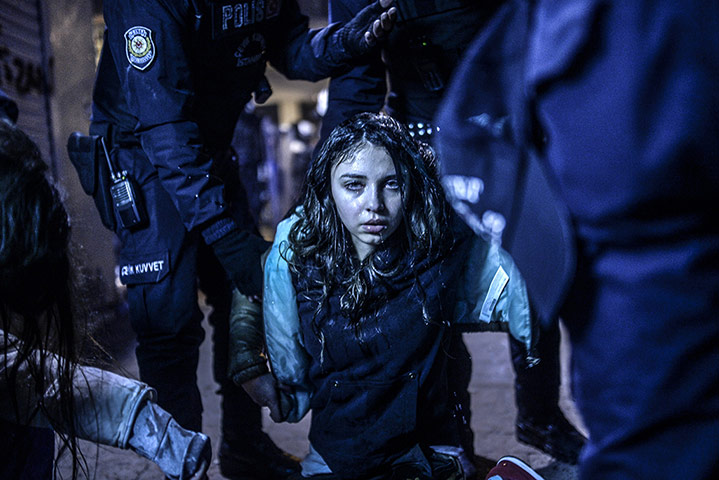 20 photos: A young girl injured in Istanbul