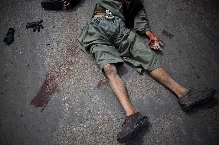 20 photos: A dead suicide bomber in Kandahar