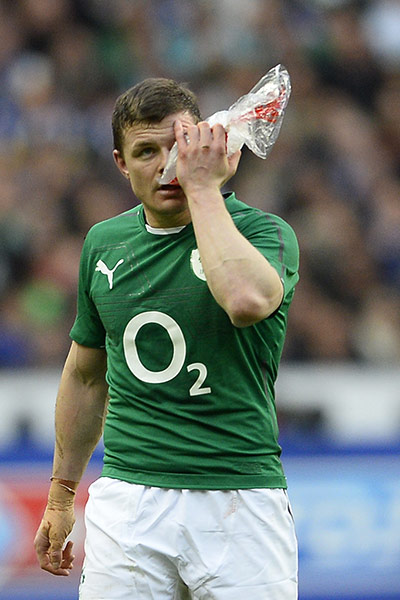 france v ireland: Ireland's centre Brian O'Driscoll holds ice to his eye