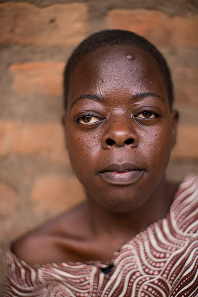 Sightsavers Uganda: Nabirye Haliyati