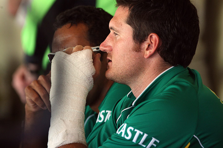 Graeme Smith's career: Graeme Smith broken hand