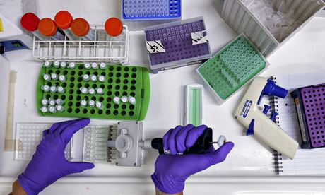 File photo shows a scientist preparing protein samples for analysis 