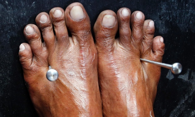 Two five-inch stainless steel nails pierce through the feet of a penitent  in San Fernando, Philippines.