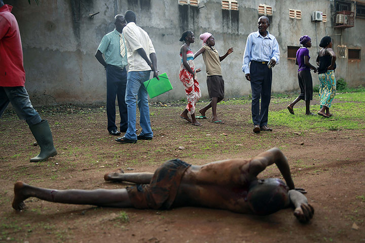 20 Photos: A man lays in pain after being attacked by a man with a machete in Bangui