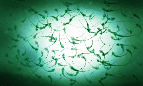 Microscopic image of sperm