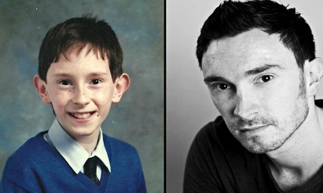 James Dawson before and after