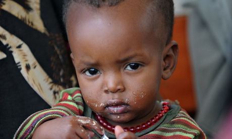 Child eating Plumpy Nut Ethiopia