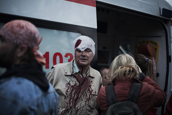 20 Photos: A pro-Ukrainian man after being beaten by pro-Russia activists in Donetsk