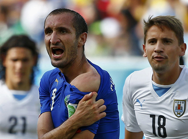 20 Photos: The bite marks on Giorgio Chiellini's shoulder
