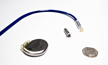 Pill-sized pacemaker implanted in heart of British patient