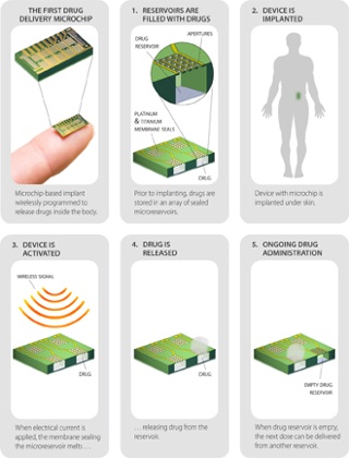 Remote birth control … How the micro-dispensing chip works.