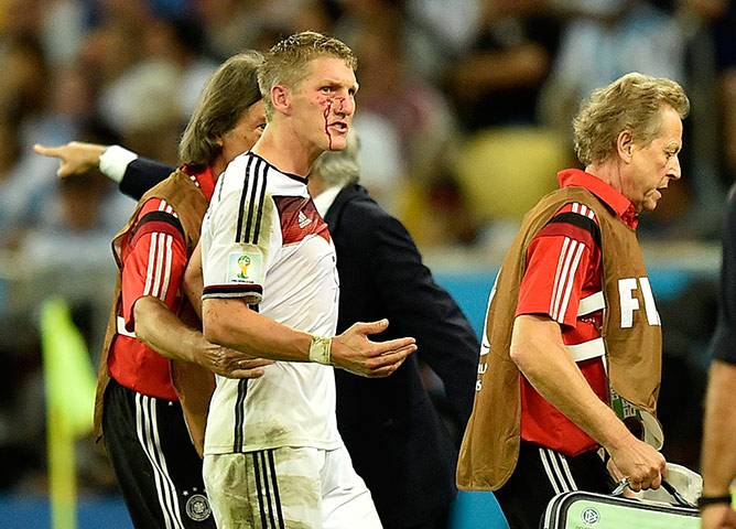 Schweinsteigar's Final: Schweinsteiger is bleeding