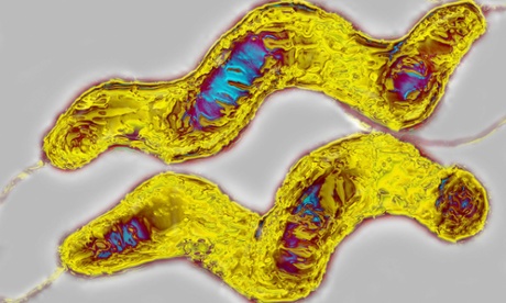 Campylobacter is the most common form of food poisoning in the UK.