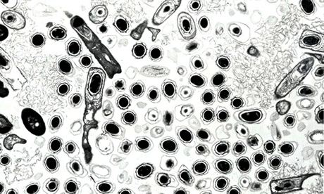 Anthrax bacteria