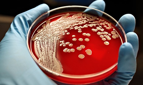http://www.theguardian.com/society/2014/jul/02/cameron-superbugs-dark-ages-medicine