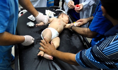 A Palestinian boy lies on a bed at a hospital in the northern Gaza Israel-Gaza conflict, Gaza Strip, Palestinian Territories - 24 Jul 2014.