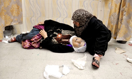 A Palestinian woman lies at a hospital in the northern Gaza Israel-Gaza conflict, Gaza Strip, Palestinian Territories - 24 Jul 2014