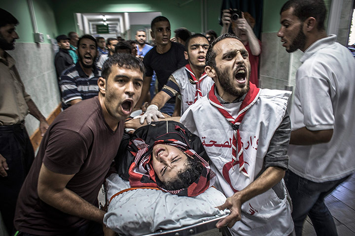 20 photos: Palestinians rush a man into hospital