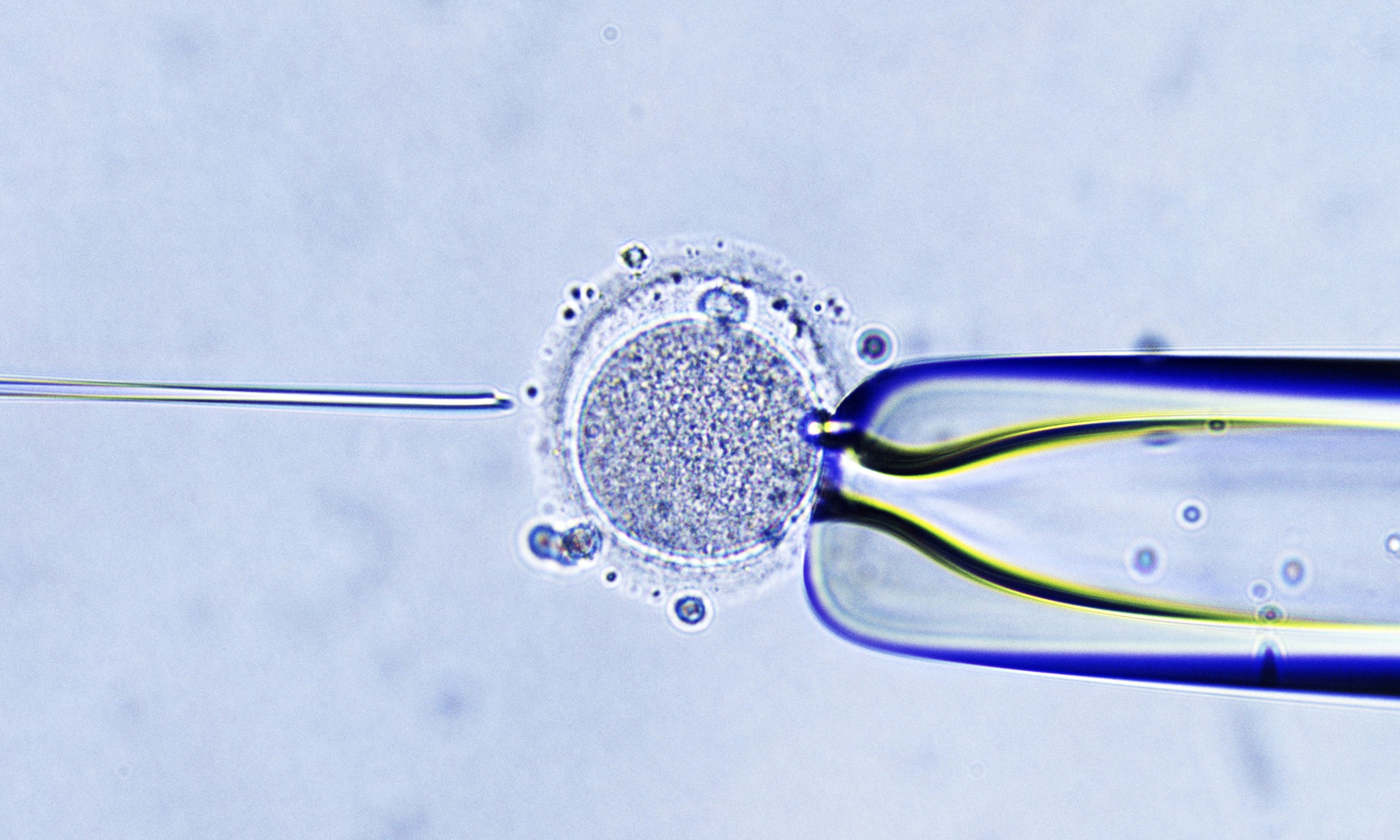 Ivf sperm donation