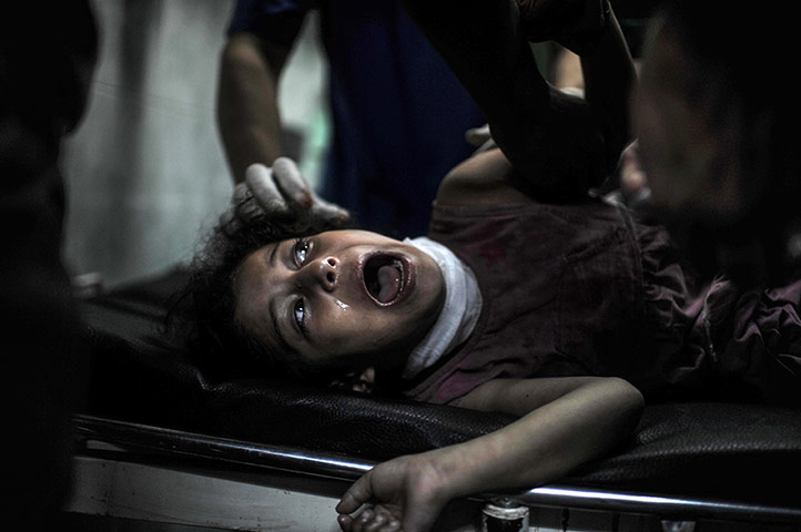 20 photos: An injured Palestinian child