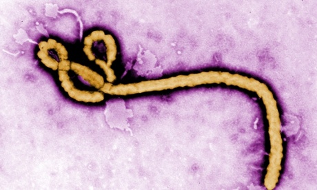 Handout photo of the ebola virus.