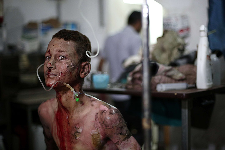20 photos: A seriously wounded Syrian youth is treated at a makeshift hospital