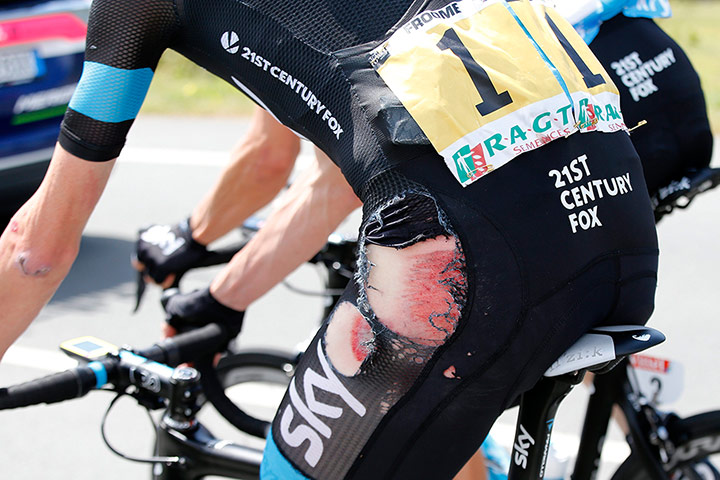 froome: Froome injury in the 4th stage