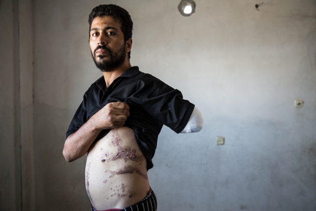Nabil Siyam lost his wife and children as well as his arm when the family tried to flee a strike