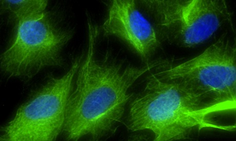 Scientists hail creation of working organ made from laboratory cells