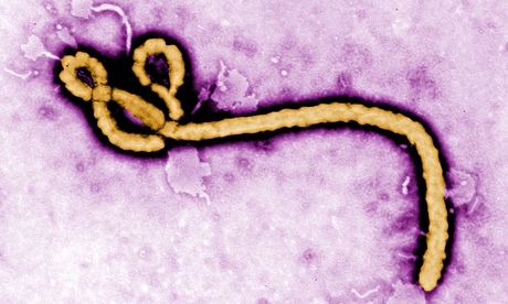 Ebola virus