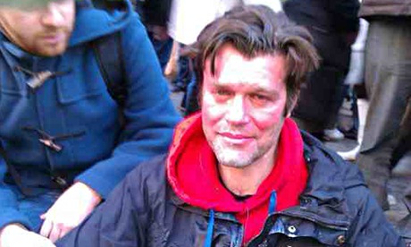 Mike Firth after being sprayed in face with CS gas during a UK Uncut protest outside Boots in Januar