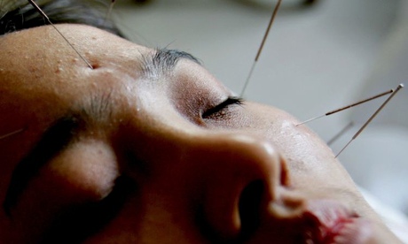 A woman receives acupuncture treatment to relieve her black eye